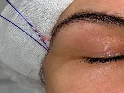 Medycyna Estetyczna - dr n. med. Agnieszka Ledniowska